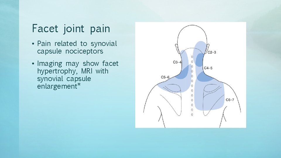 Facet joint pain • Pain related to synovial capsule nociceptors • Imaging may show