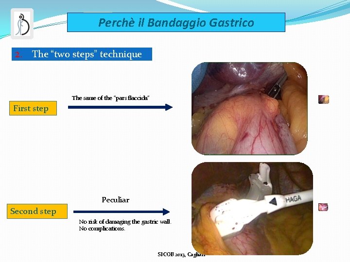 Perchè il Bandaggio Gastrico 2. The “two steps” technique The same of the “pars