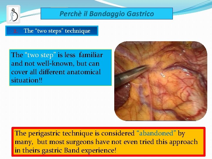 Perchè il Bandaggio Gastrico 2. The “two steps” technique The “two step” is less