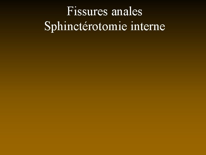 Fissures anales Sphinctérotomie interne 