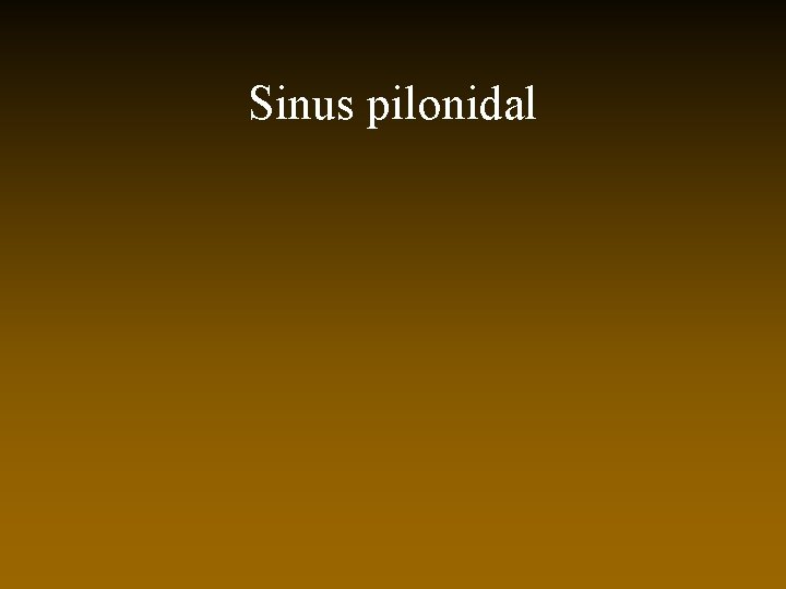 Sinus pilonidal 