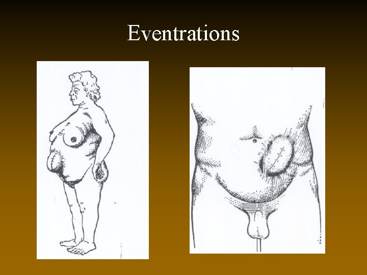 Eventrations 