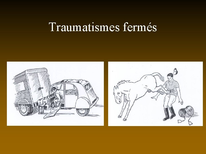 Traumatismes fermés 