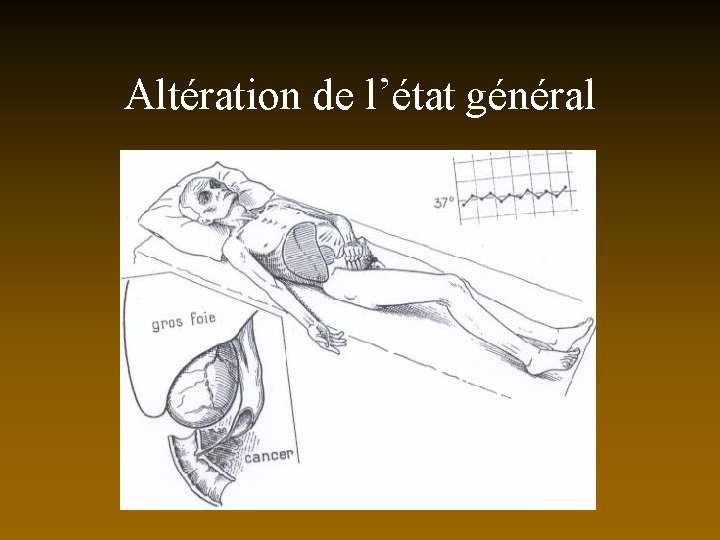 Altération de l’état général 