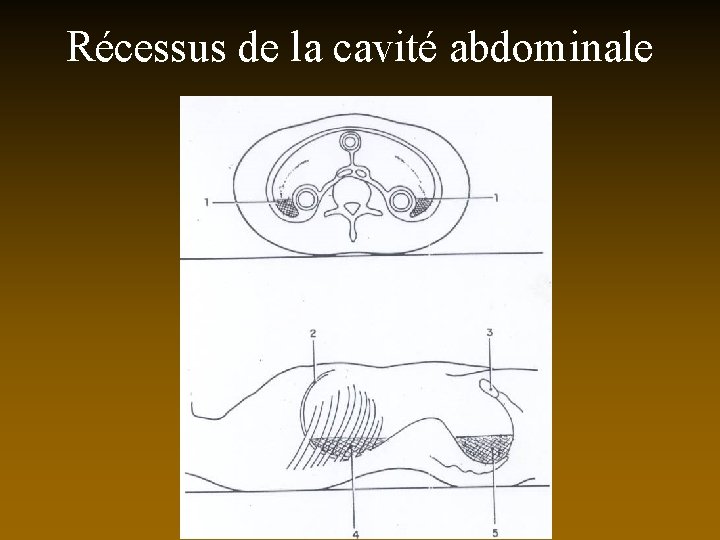 Récessus de la cavité abdominale 