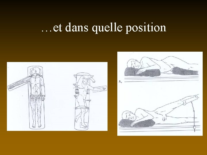 …et dans quelle position 