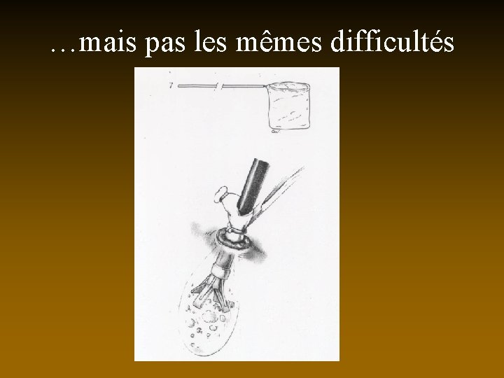 …mais pas les mêmes difficultés 