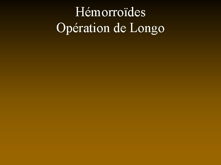 Hémorroïdes Opération de Longo 
