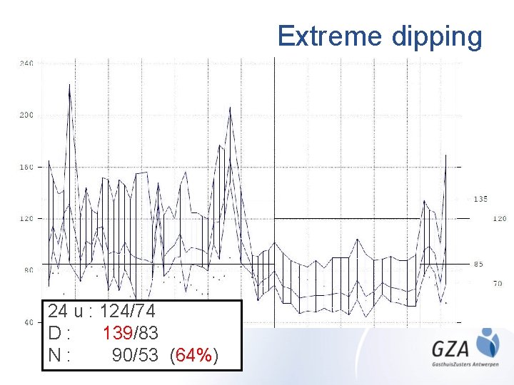 Extreme dipping 24 u : 124/74 D: 139/83 N: 90/53 (64%) 