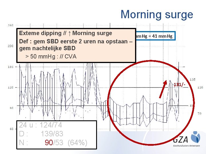 Morning surge Exteme dipping // ↑ Morning surge 131 -90 mm. Hg = 41