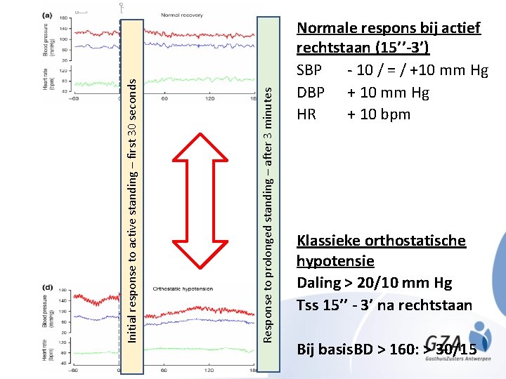 Response to prolonged standing – after 3 minutes Initial response to active standing –