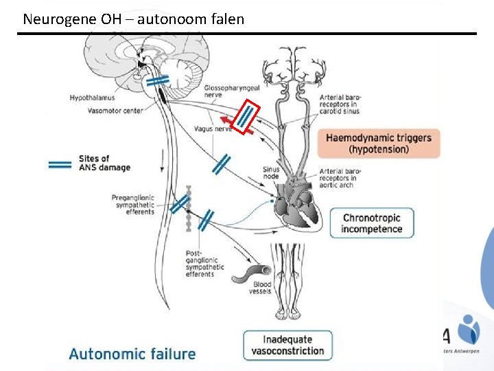 Neurogene OH – autonoom falen 