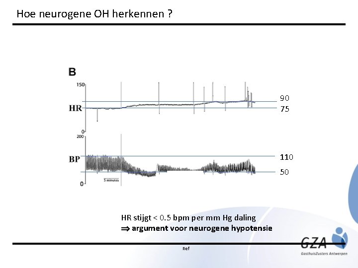 Hoe neurogene OH herkennen ? 90 75 110 50 HR stijgt < 0. 5