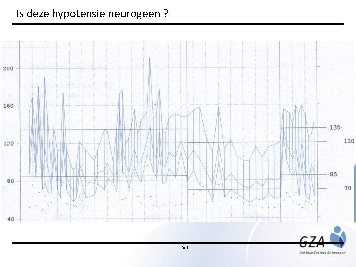 Is deze hypotensie neurogeen ? Ref 