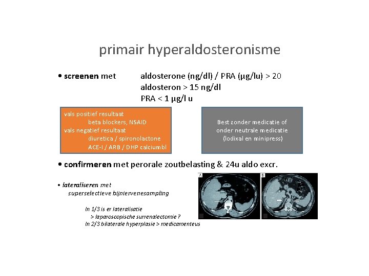 primair hyperaldosteronisme • screenen met aldosterone (ng/dl) / PRA (µg/lu) > 20 aldosteron >