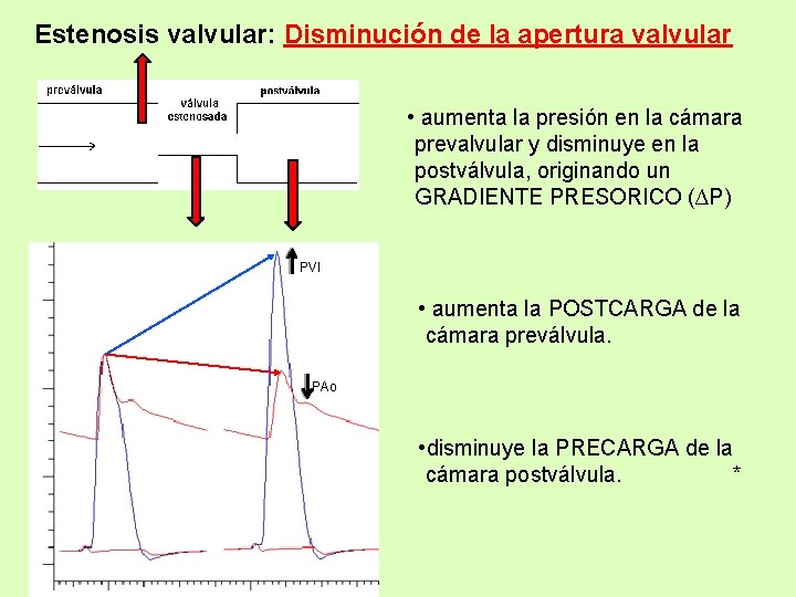 Estenosis valvular: Disminución de la apertura valvular • aumenta la presión en la cámara