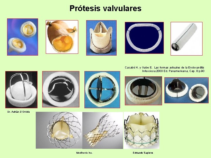 Prótesis valvulares Casabé H. y Gabe E. Las formas actuales de la Endocarditis Infecciosa.