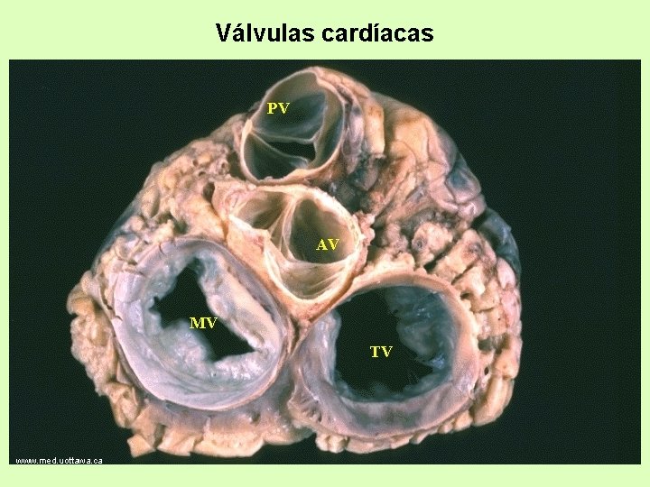 Válvulas cardíacas www. med. uottawa. ca 