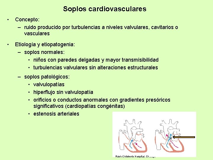 Soplos cardiovasculares • Concepto: – ruido producido por turbulencias a niveles valvulares, cavitarios o