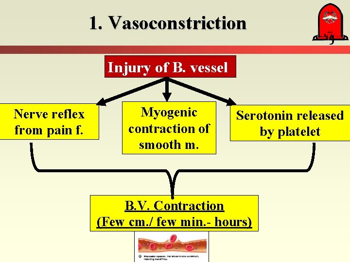 1. Vasoconstriction Injury of B. vessel Nerve reflex from pain f. Myogenic contraction of