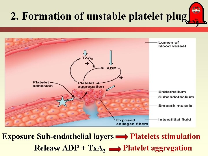 2. Formation of unstable platelet plug Exposure Sub-endothelial layers Release ADP + Tx. A