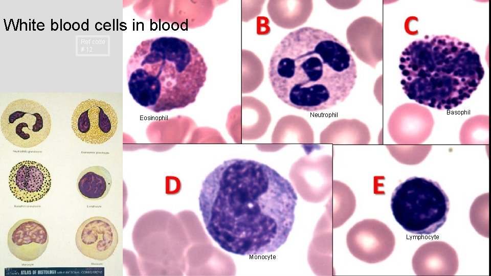 White blood cells in blood Ref code # 12 Basophil Neutrophil Eosinophil Lymphocyte Monocyte