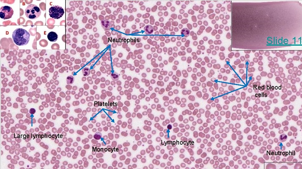 Slide 11 Neutrophils Red blood cells Platelets Large lymphocyte Monocyte Lymphocyte Neutrophil 