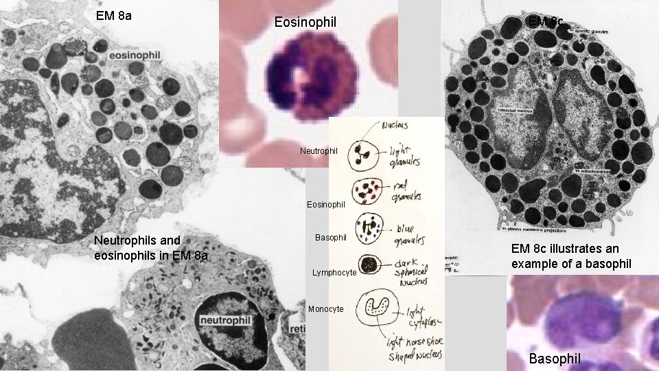 EM 8 a Eosinophil EM 8 c Neutrophil Eosinophil Neutrophils and eosinophils in EM