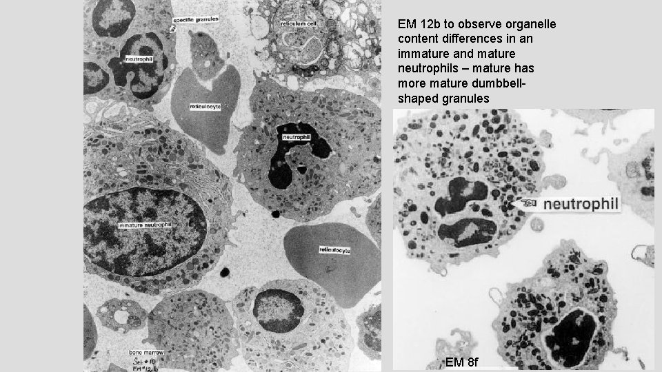 EM 12 b to observe organelle content differences in an immature and mature neutrophils