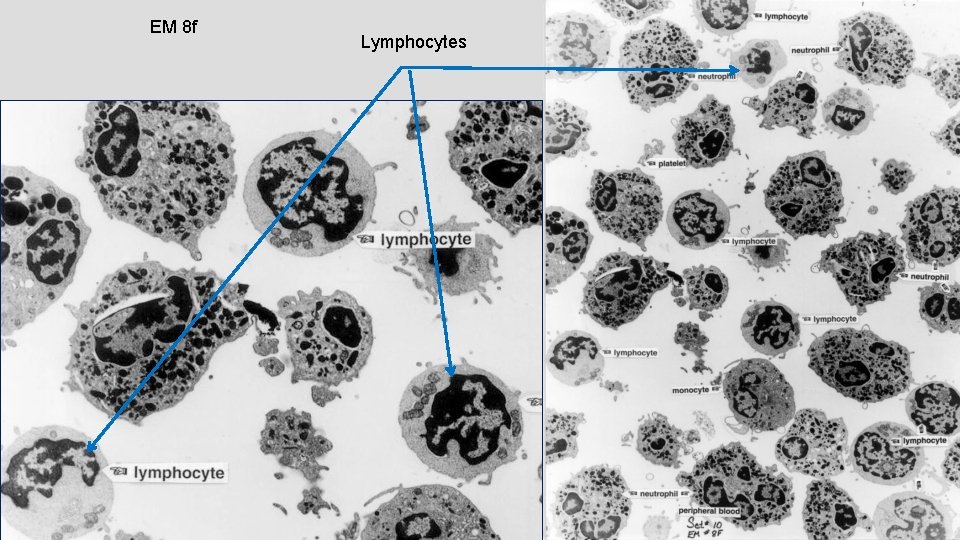 EM 8 f Lymphocytes 