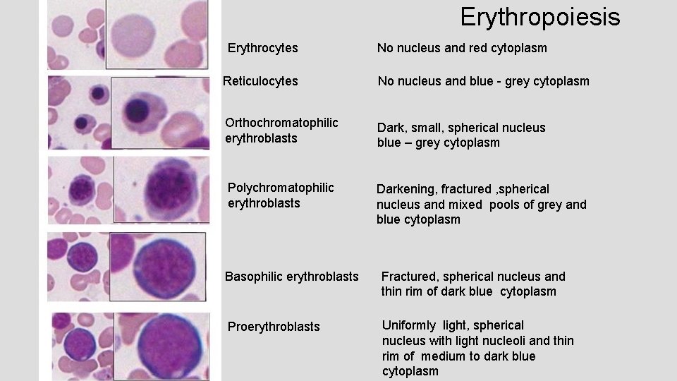 Erythropoiesis Erythrocytes No nucleus and red cytoplasm Reticulocytes No nucleus and blue - grey