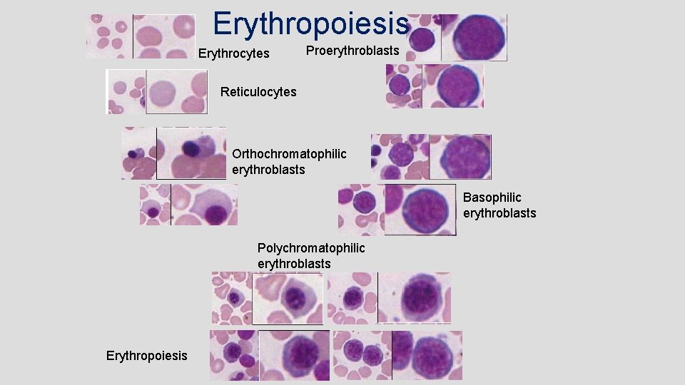 Erythropoiesis Erythrocytes Proerythroblasts Reticulocytes Orthochromatophilic erythroblasts Basophilic erythroblasts Polychromatophilic erythroblasts Erythropoiesis 