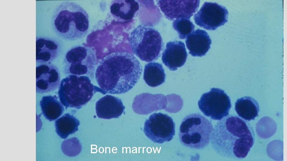 Bone marrow 