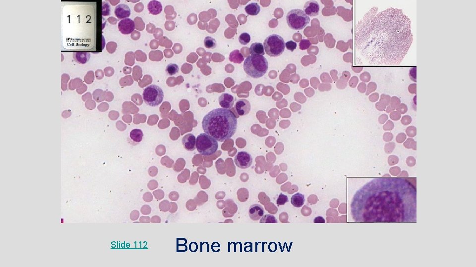 Slide 112 Bone marrow 