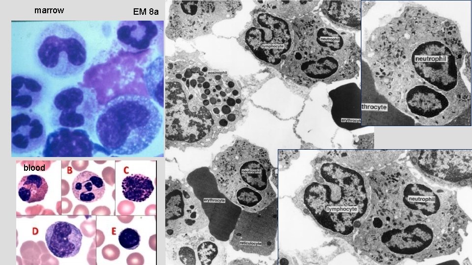 marrow blood EM 8 a 