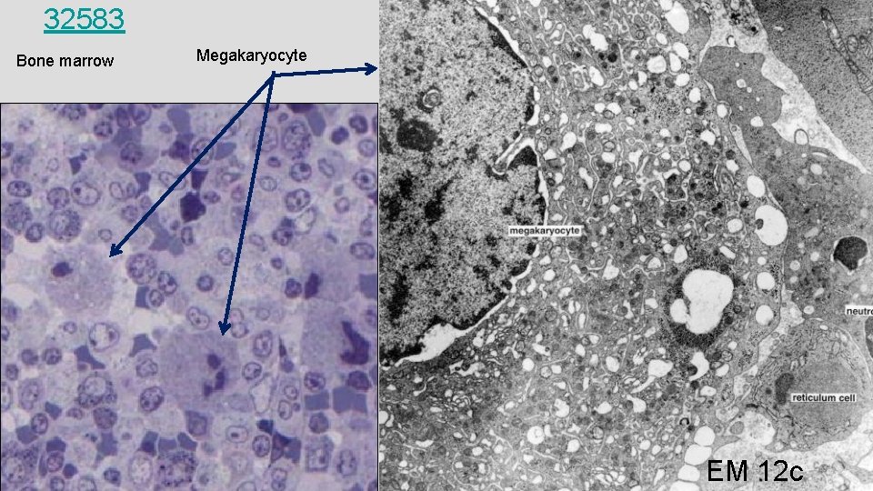 32583 Bone marrow Megakaryocyte EM 12 c 