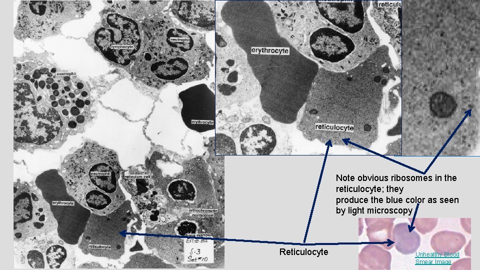 Note obvious ribosomes in the reticulocyte; they produce the blue color as seen by