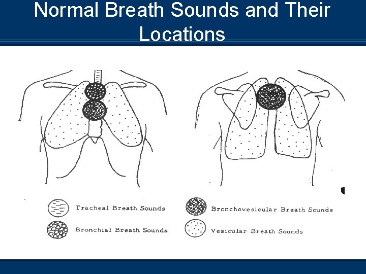 Normal Breath Sounds and Their Locations 