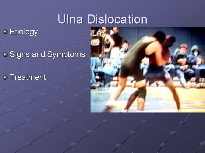 Ulna Dislocation Etiology Signs and Symptoms Treatment 