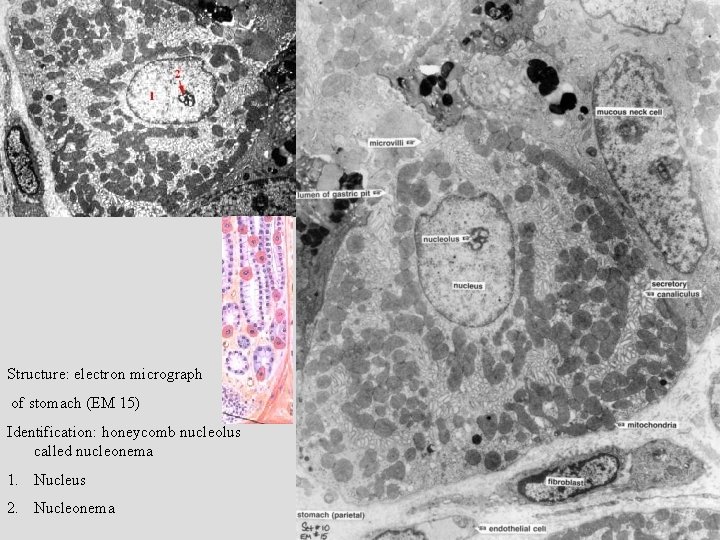 Structure: electron micrograph of stomach (EM 15) Identification: honeycomb nucleolus called nucleonema 1. Nucleus