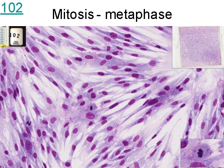 102 Mitosis - metaphase 