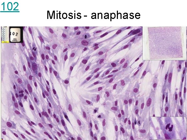 102 Mitosis - anaphase 