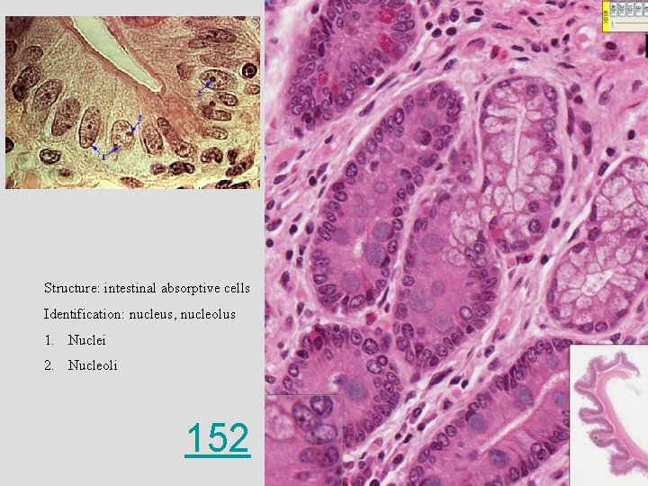 Structure: intestinal absorptive cells Identification: nucleus, nucleolus 1. Nuclei 2. Nucleoli 152 201 