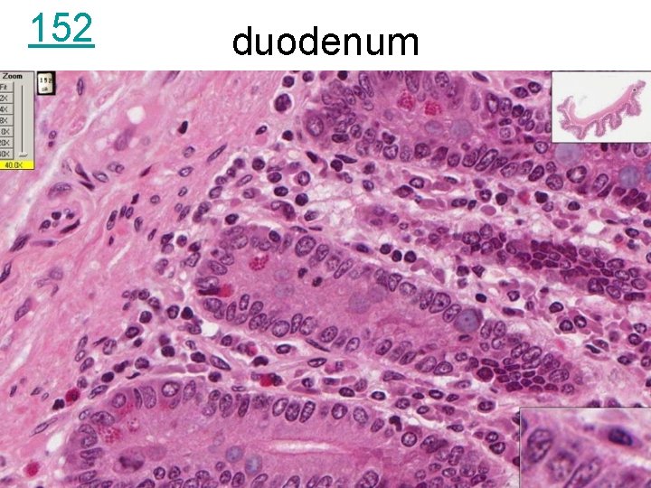 152 duodenum 