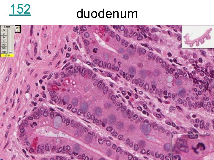 152 duodenum 