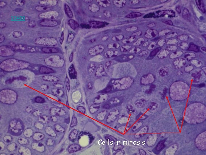 32409 Cells in mitosis 