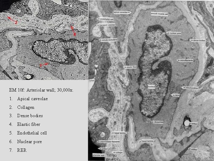 EM 10 f: Arteriolar wall; 30, 000 x. 1. Apical caveolae 2. Collagen 3.