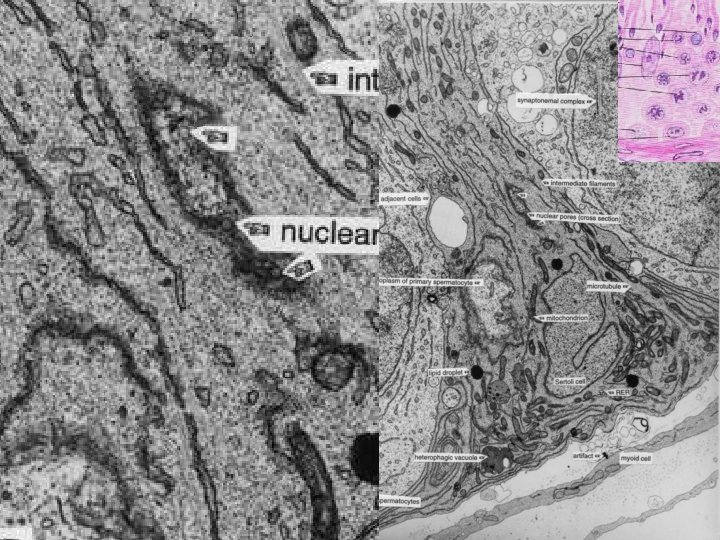EM 19 c: Sertoli cell; 13, 300 x. 1. Golgi 2. Heterophagic vacuole 3.