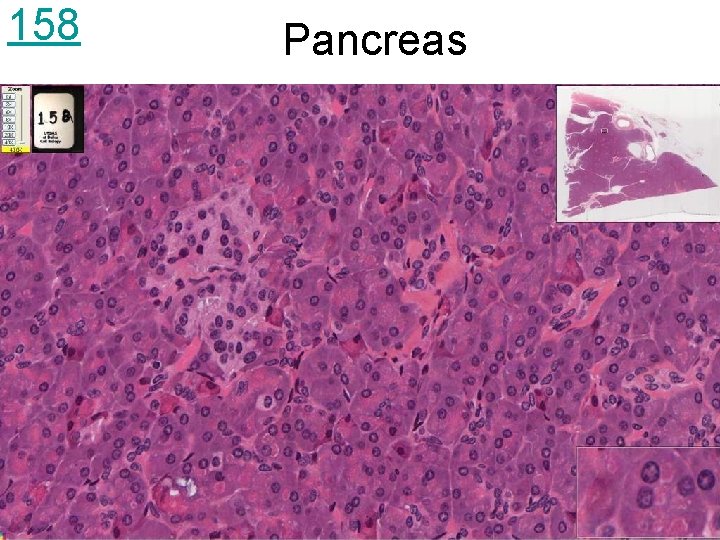 158 Pancreas 