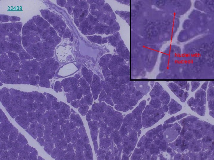 32409 Nuclei with nucleoli 